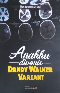 Anakku divonis Dandy Walker Variant