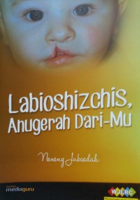 Labioshizchis, anugerah dari-Mu