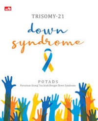 Trisomy-21 : down syndrome